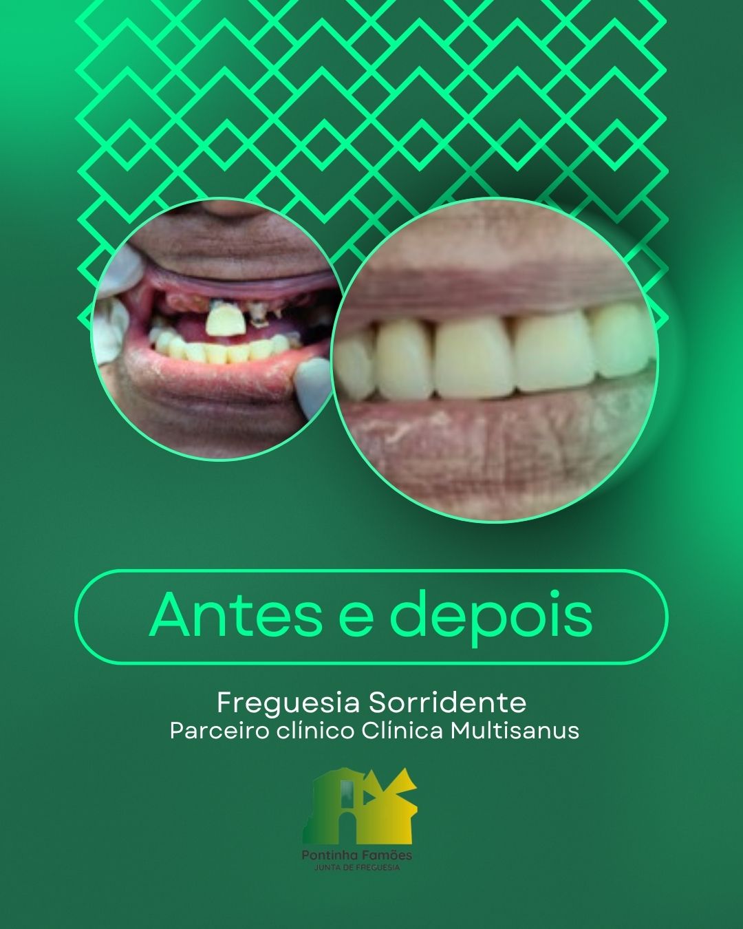 https://bo.jf-pontinhafamoes.pt/FileUploads/noticias/implantes-dentarios-que-devolvem-sua-confianca-em-sorrir.-1.jpg